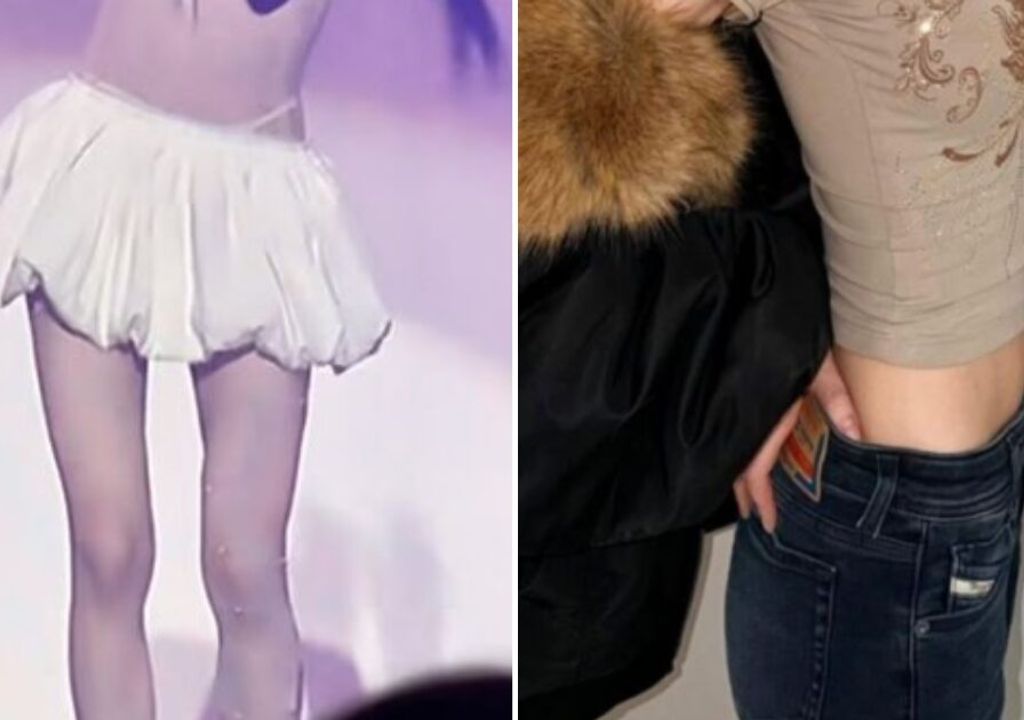 Emagrecimento extremo de idols femininas gera onda de preocupação