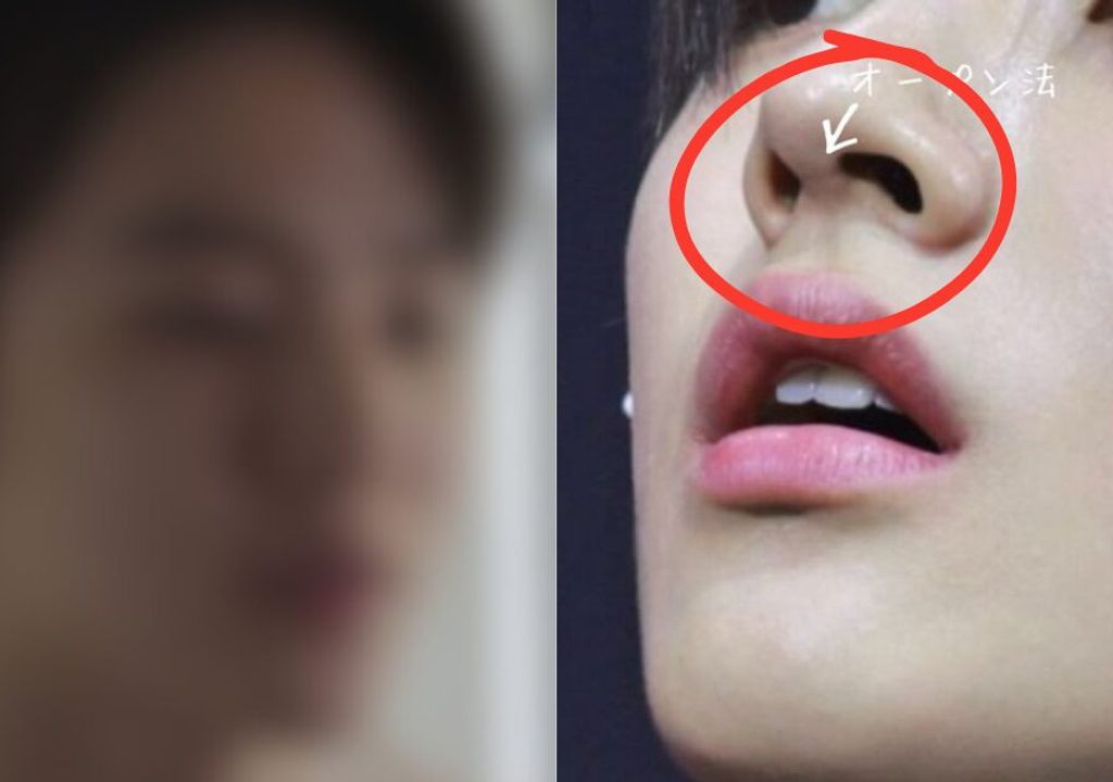 Membro do CORTIS é acusado de cirurgia plástica após fãs apontarem cicatriz