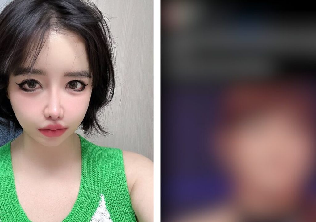 Visual de Park Bom “Antes da Cirurgia Plástica” Viraliza em Meio a Acusações Contra YG Entertainment